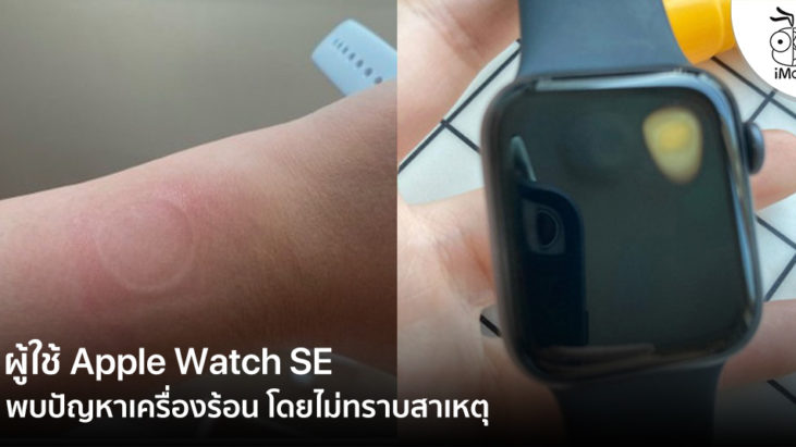 Apple Watch SE ร้อน - ข้อมูล ข่าว รีวิว อัปเดตล่าสุดโดย iPhoneMod